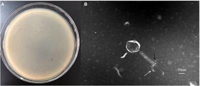 Characterization and Genomic Analysis of a Novel Jumbo Bacteriophage vB_StaM_SA1 Infecting Staphylococcus aureus With Two Lysins